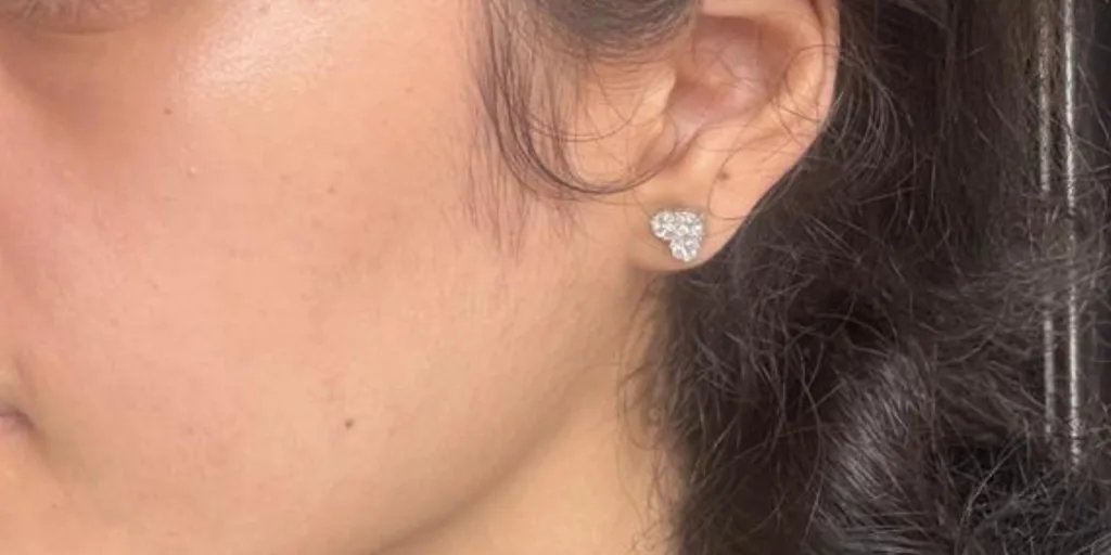 clean skin